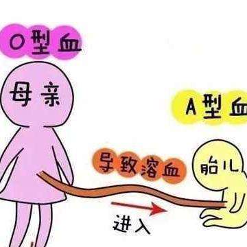 abo溶血什么情况下会发生