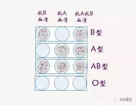 abo血型溶血